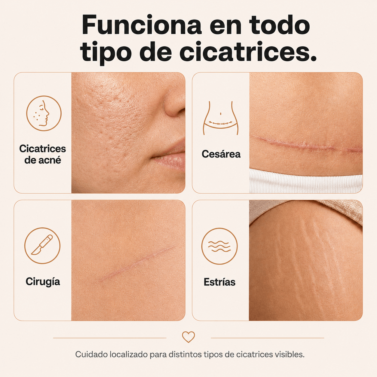 Bloss Stick - Borrador de cicatrices